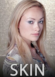Skin poster