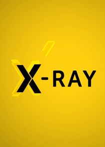 X-Ray poster