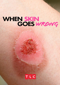 When Skin Goes Wrong poster